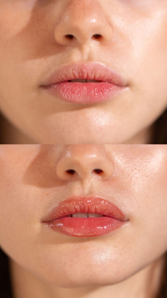 How To Get Prettier Naturally With Easy Beauty Hacks At Home How To Be Pretty Without Doing Too Much: 28 Beauty Hacks That Lowkey Eat