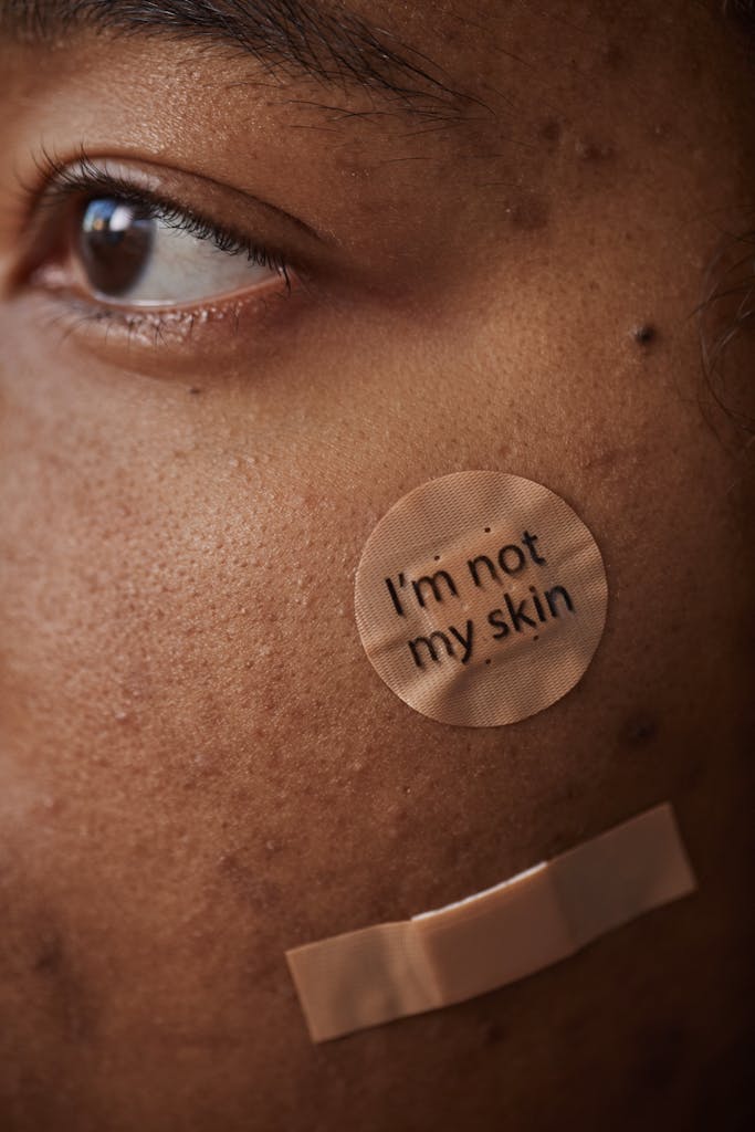 How To Start Accepting Your Skin And Feel More Confident how to accept your skin