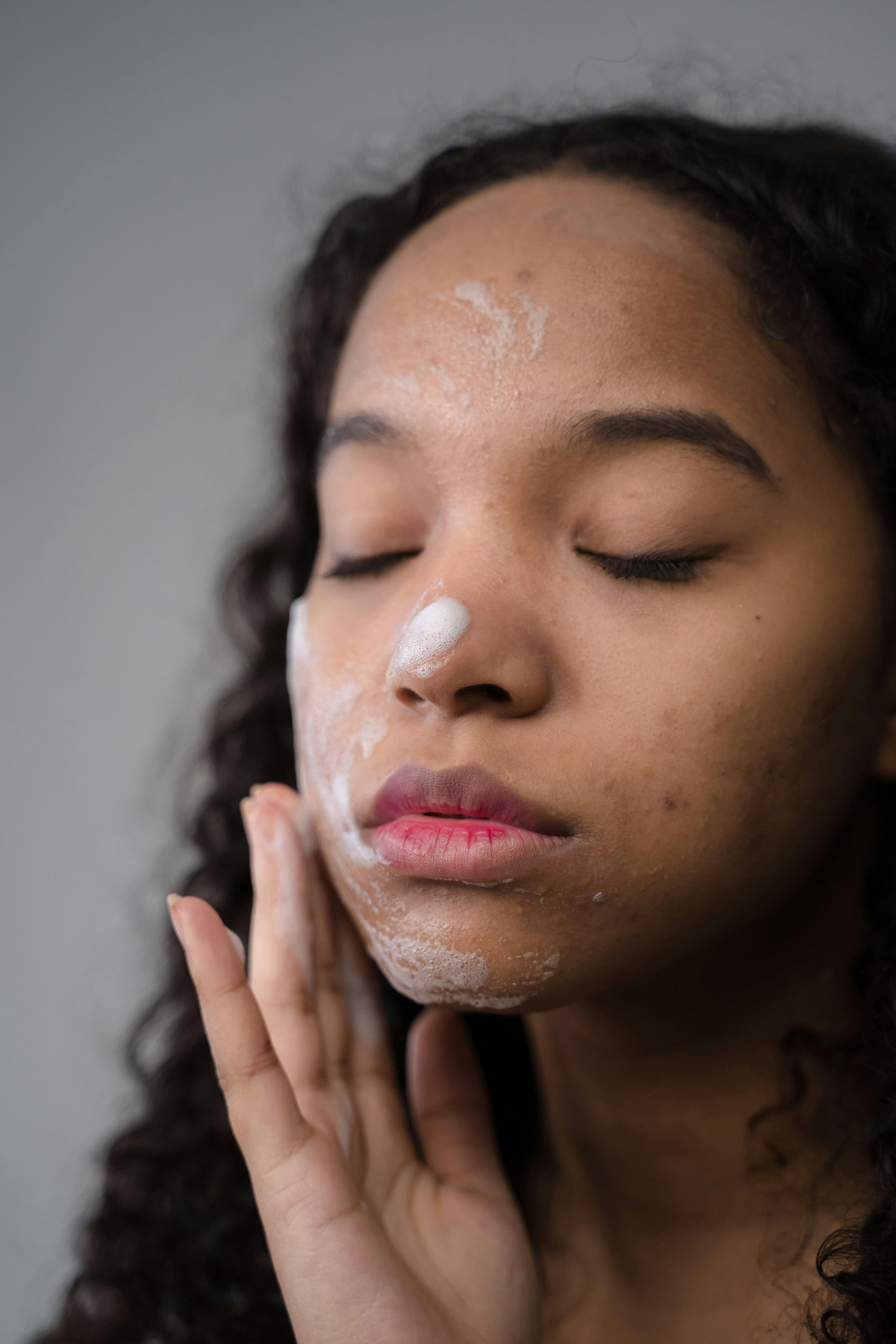 How To Start Accepting Your Skin And Feel More Confident